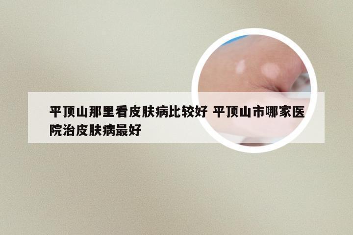平顶山那里看皮肤病比较好 平顶山市哪家医院治皮肤病最好