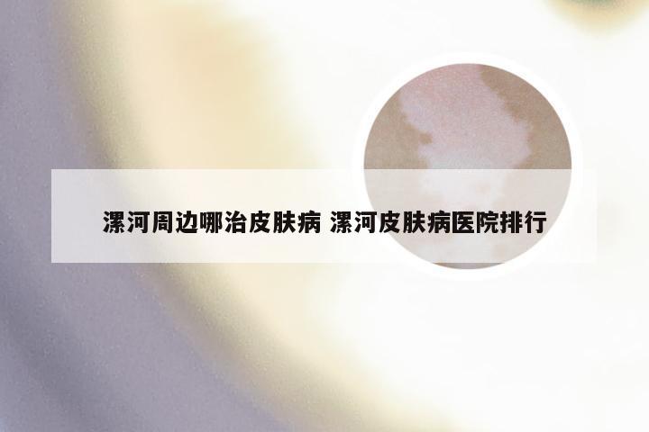 漯河周边哪治皮肤病 漯河皮肤病医院排行