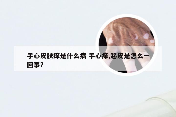 手心皮肤痒是什么病 手心痒,起皮是怎么一回事?
