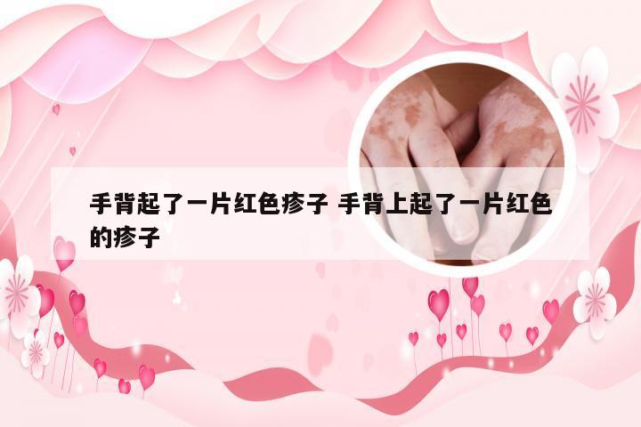 手背起了一片红色疹子 手背上起了一片红色的疹子