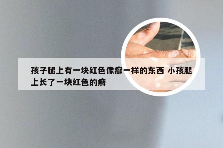 孩子腿上有一块红色像癣一样的东西 小孩腿上长了一块红色的癣