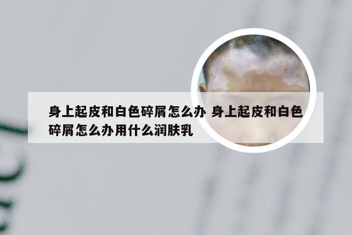 身上起皮和白色碎屑怎么办 身上起皮和白色碎屑怎么办用什么润肤乳