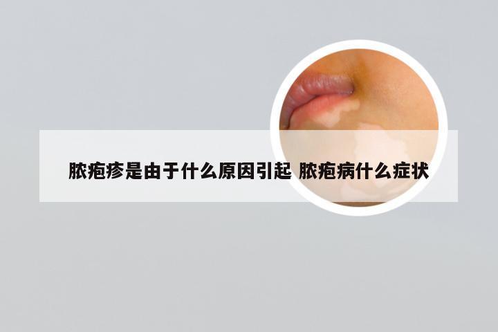 脓疱疹是由于什么原因引起 脓疱病什么症状