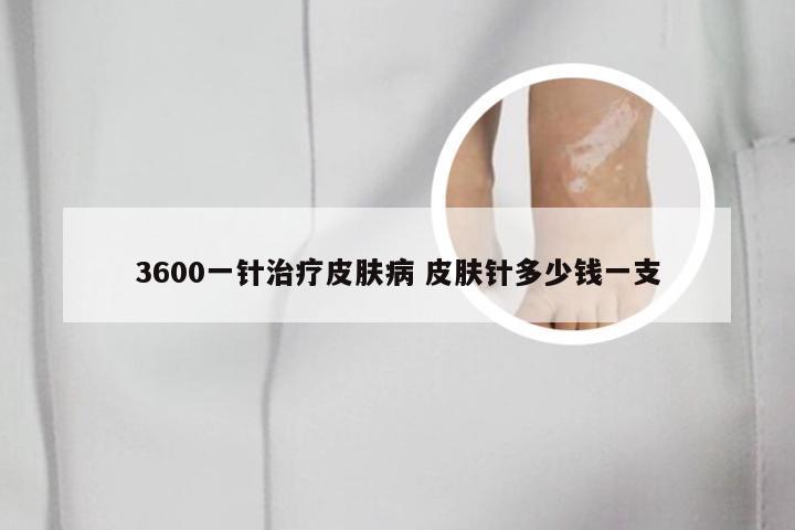 3600一针治疗皮肤病 皮肤针多少钱一支