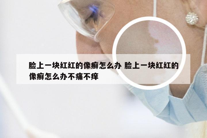 脸上一块红红的像癣怎么办 脸上一块红红的像癣怎么办不痛不痒