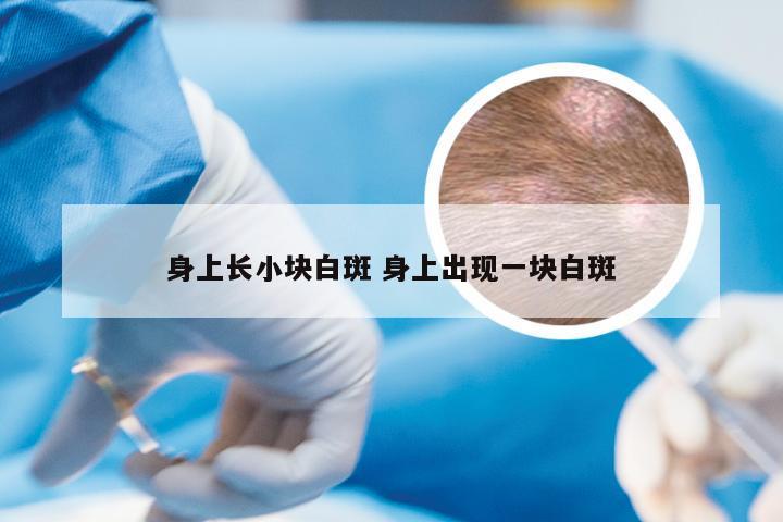 身上长小块白斑 身上出现一块白斑