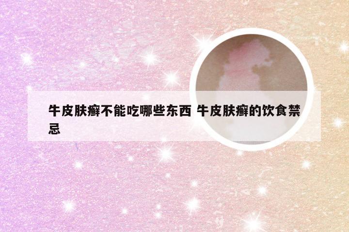 牛皮肤癣不能吃哪些东西 牛皮肤癣的饮食禁忌