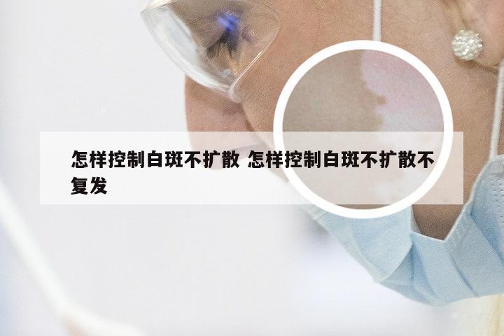 怎样控制白斑不扩散 怎样控制白斑不扩散不复发