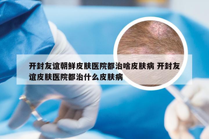 开封友谊朝鲜皮肤医院都治啥皮肤病 开封友谊皮肤医院都治什么皮肤病