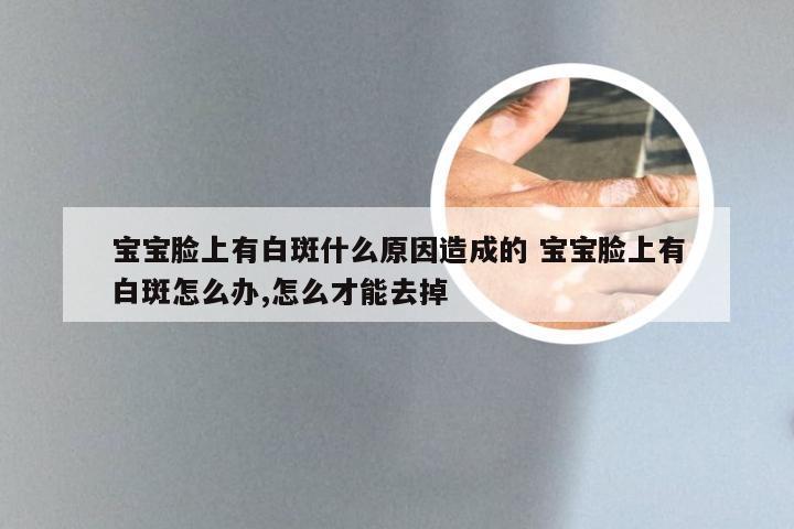 宝宝脸上有白斑什么原因造成的 宝宝脸上有白斑怎么办,怎么才能去掉