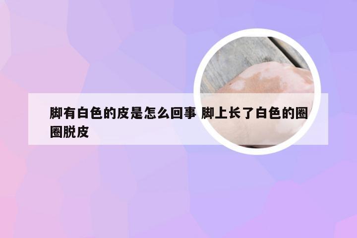 脚有白色的皮是怎么回事 脚上长了白色的圈圈脱皮