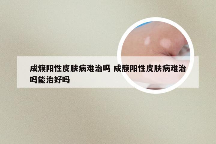 成簇阳性皮肤病难治吗 成簇阳性皮肤病难治吗能治好吗