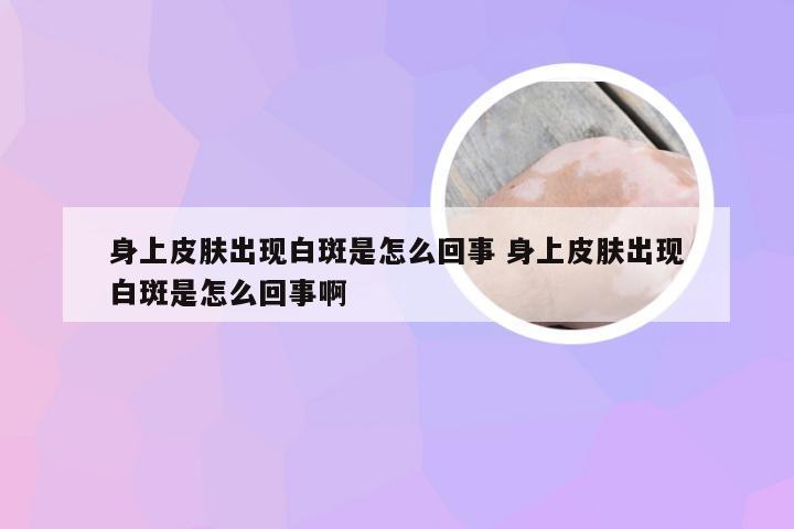 身上皮肤出现白斑是怎么回事 身上皮肤出现白斑是怎么回事啊