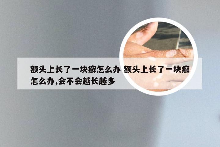 额头上长了一块癣怎么办 额头上长了一块癣怎么办,会不会越长越多