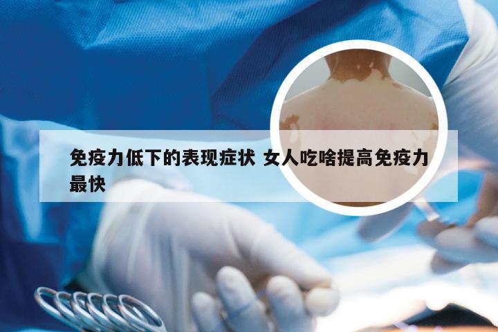 免疫力低下的表现症状 女人吃啥提高免疫力最快