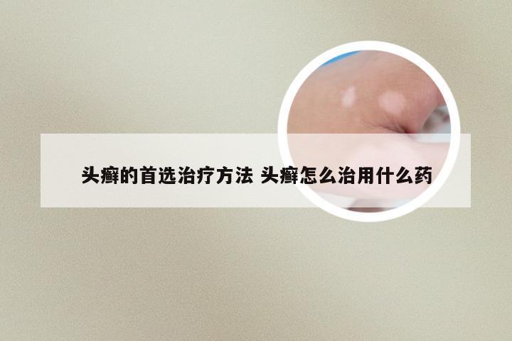 头癣的首选治疗方法 头癣怎么治用什么药