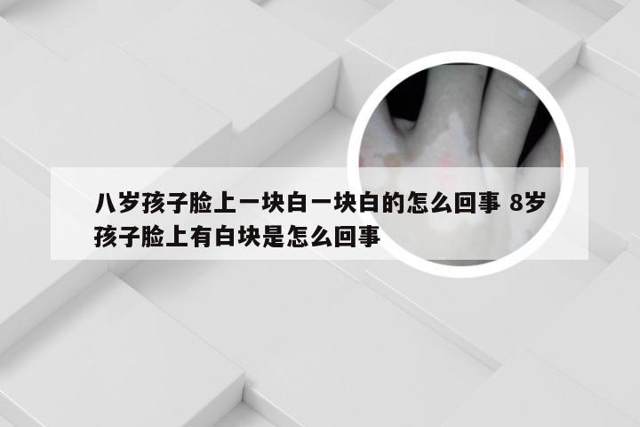 八岁孩子脸上一块白一块白的怎么回事 8岁孩子脸上有白块是怎么回事