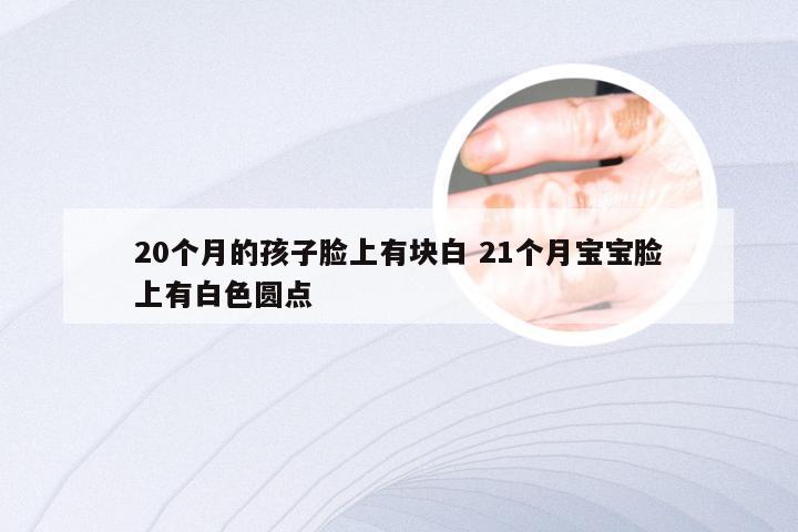 20个月的孩子脸上有块白 21个月宝宝脸上有白色圆点