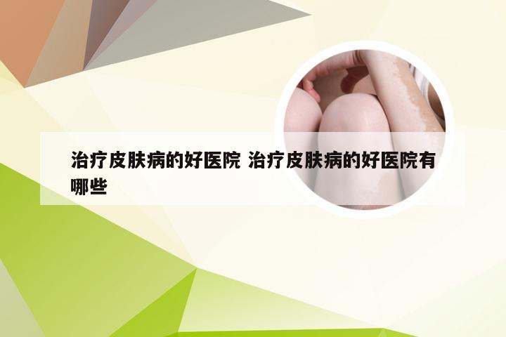 治疗皮肤病的好医院 治疗皮肤病的好医院有哪些