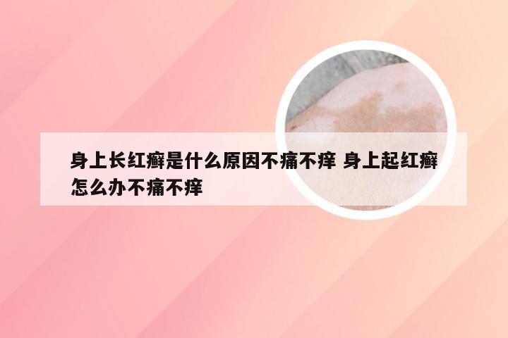 身上长红癣是什么原因不痛不痒 身上起红癣怎么办不痛不痒