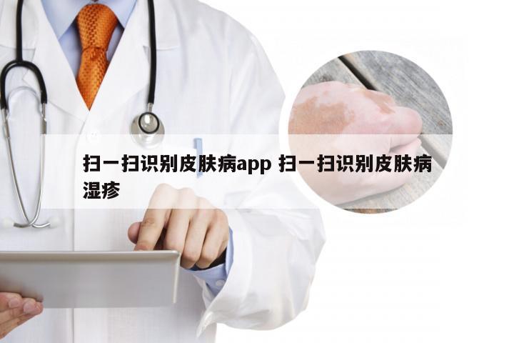 扫一扫识别皮肤病app 扫一扫识别皮肤病湿疹