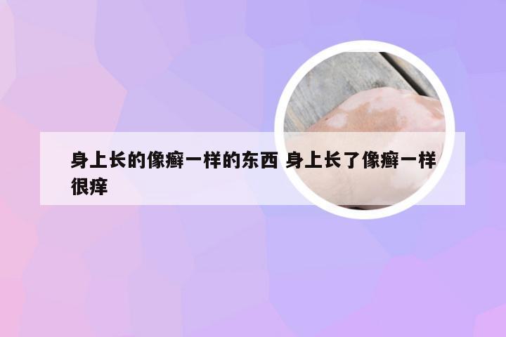 身上长的像癣一样的东西 身上长了像癣一样很痒