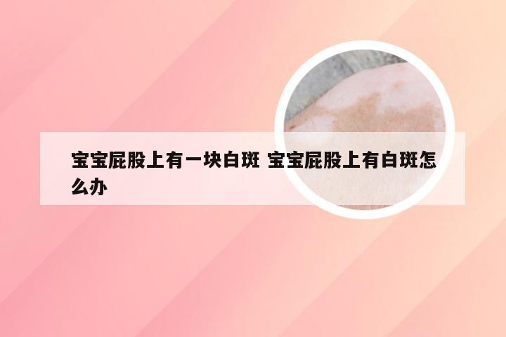 宝宝屁股上有一块白斑 宝宝屁股上有白斑怎么办