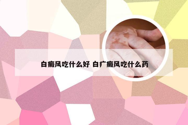 白癜风吃什么好 白疒癜风吃什么药