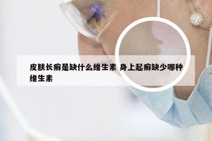 皮肤长癣是缺什么维生素 身上起癣缺少哪种维生素