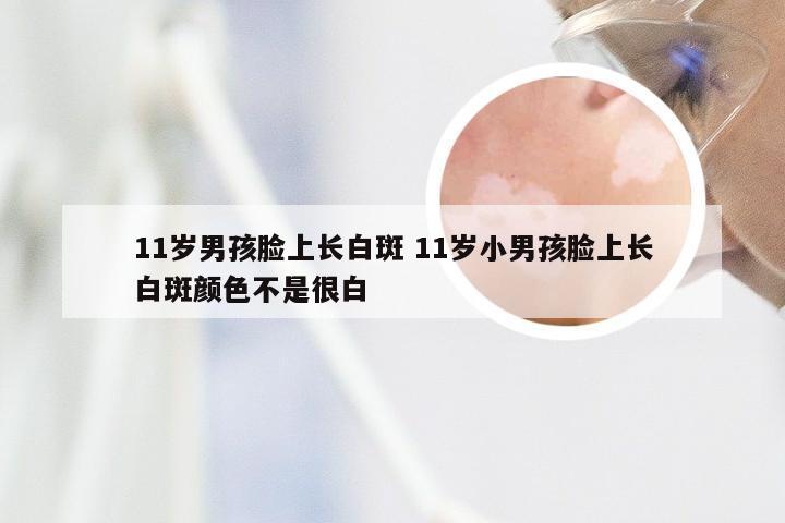 11岁男孩脸上长白斑 11岁小男孩脸上长白斑颜色不是很白