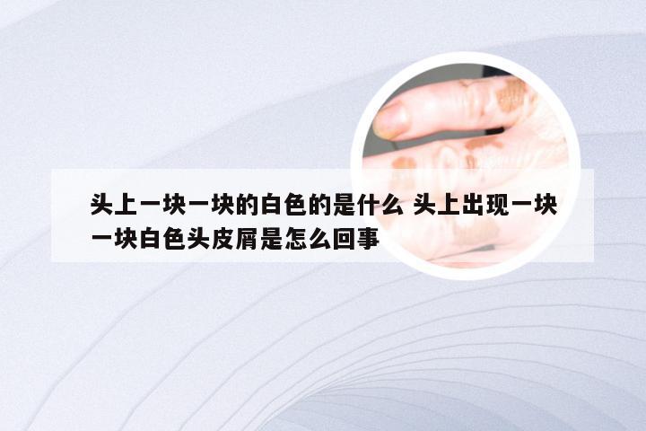 头上一块一块的白色的是什么 头上出现一块一块白色头皮屑是怎么回事