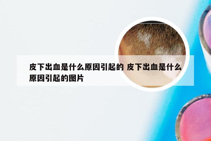 皮下出血是什么原因引起的 皮下出血是什么原因引起的图片