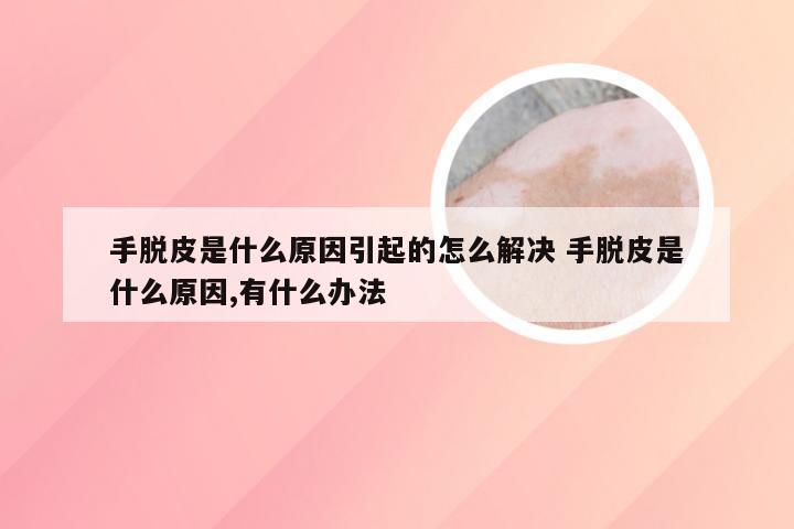 手脱皮是什么原因引起的怎么解决 手脱皮是什么原因,有什么办法