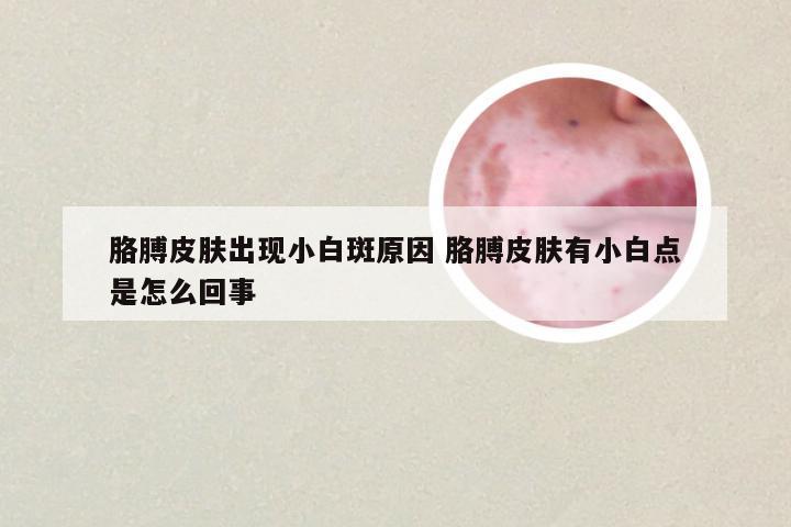 胳膊皮肤出现小白斑原因 胳膊皮肤有小白点是怎么回事