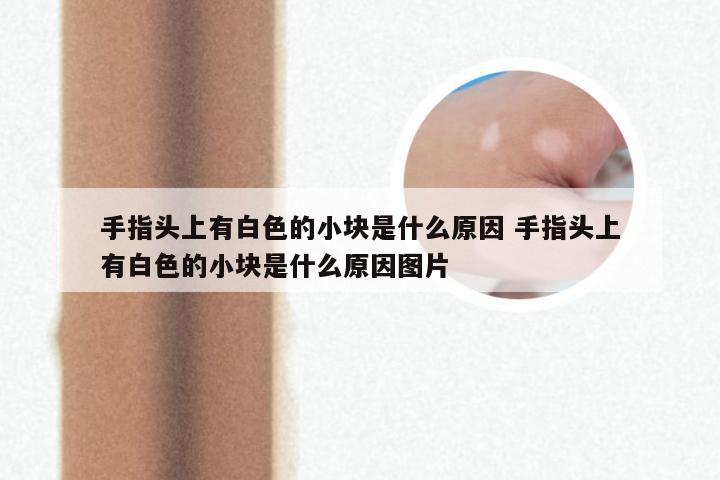 手指头上有白色的小块是什么原因 手指头上有白色的小块是什么原因图片
