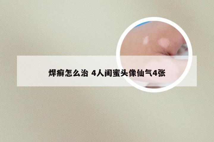 焊癣怎么治 4人闺蜜头像仙气4张