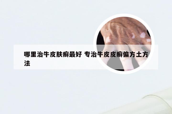 哪里治牛皮肤癣最好 专治牛皮皮癣偏方土方法
