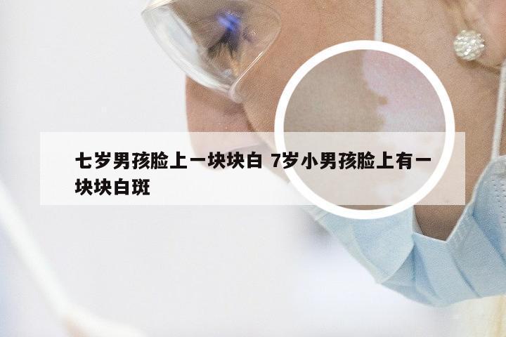 七岁男孩脸上一块块白 7岁小男孩脸上有一块块白斑