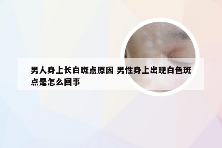 男人身上长白斑点原因 男性身上出现白色斑点是怎么回事