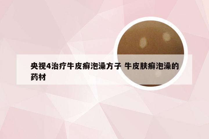 央视4治疗牛皮癣泡澡方子 牛皮肤癣泡澡的药材
