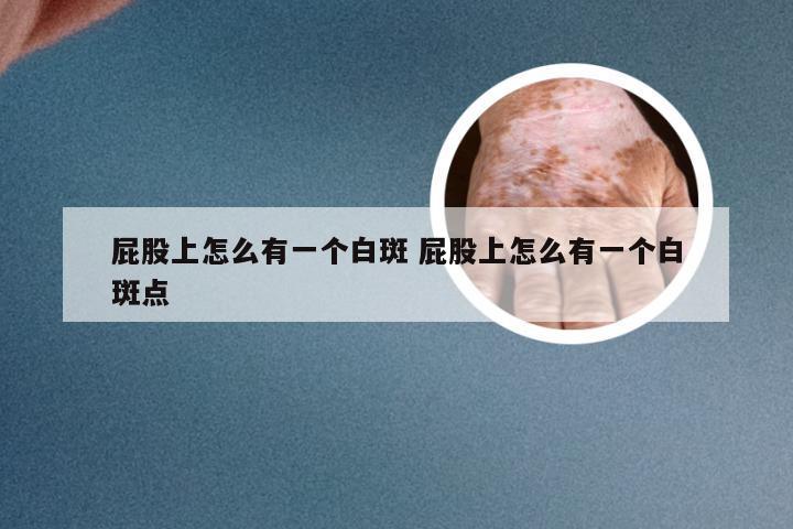 屁股上怎么有一个白斑 屁股上怎么有一个白斑点