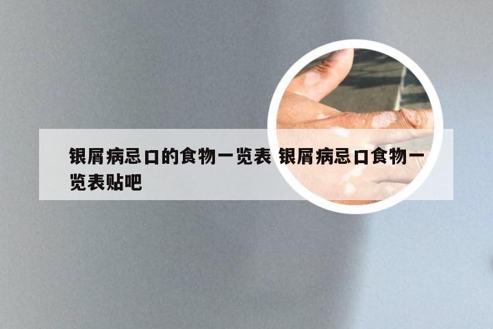 银屑病忌口的食物一览表 银屑病忌口食物一览表贴吧