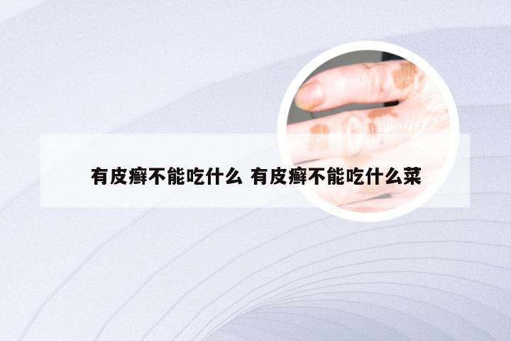 有皮癣不能吃什么 有皮癣不能吃什么菜