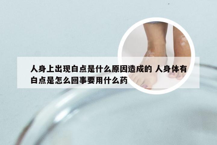 人身上出现白点是什么原因造成的 人身体有白点是怎么回事要用什么药