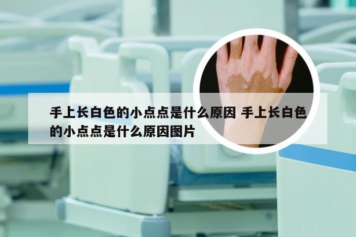 手上长白色的小点点是什么原因 手上长白色的小点点是什么原因图片