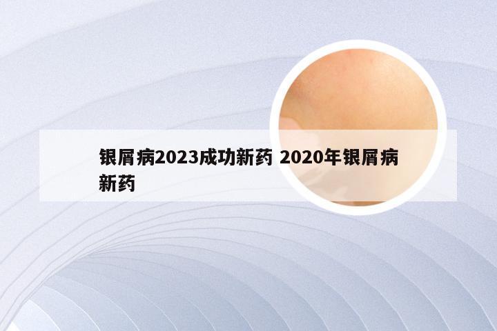 银屑病2023成功新药 2020年银屑病新药