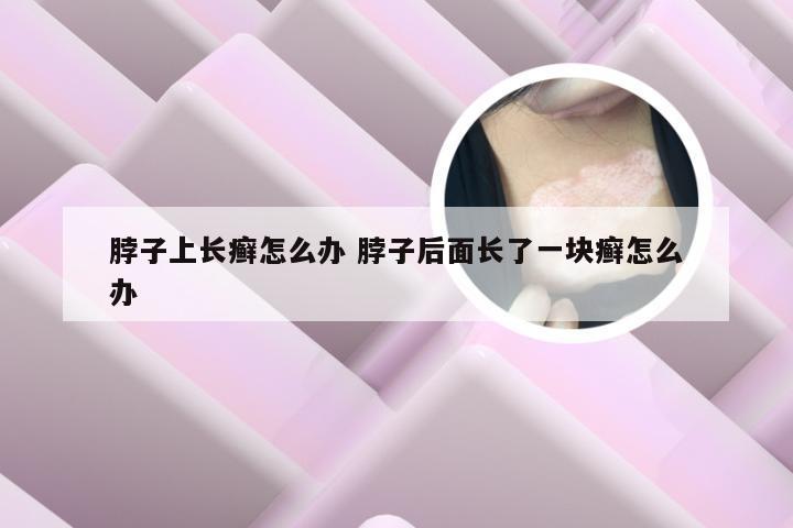 脖子上长癣怎么办 脖子后面长了一块癣怎么办