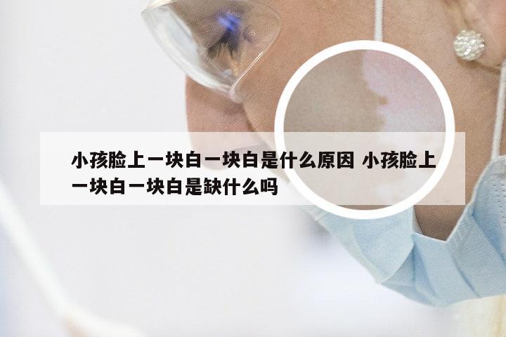 小孩脸上一块白一块白是什么原因 小孩脸上一块白一块白是缺什么吗