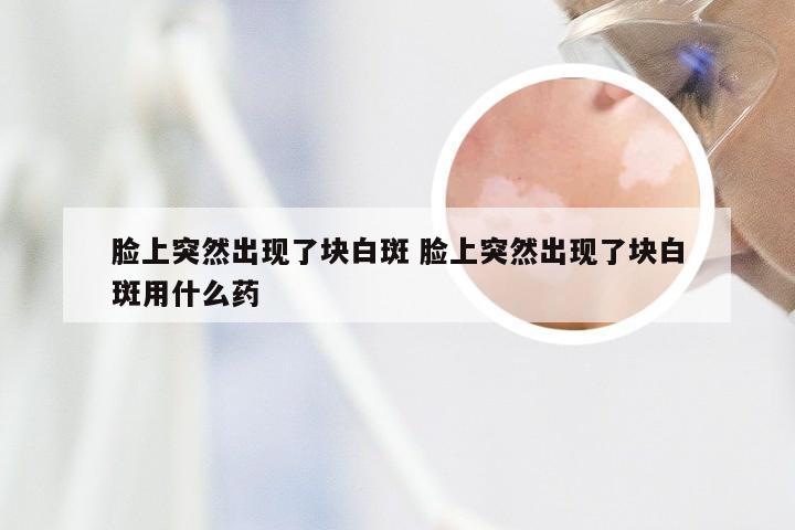 脸上突然出现了块白斑 脸上突然出现了块白斑用什么药