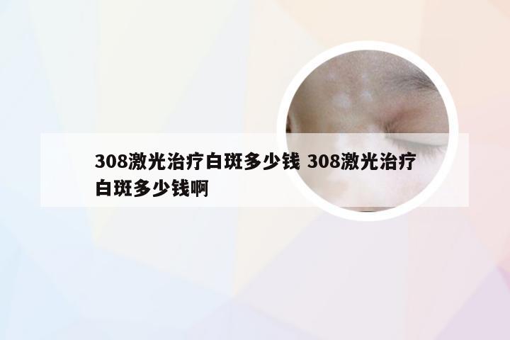 308激光治疗白斑多少钱 308激光治疗白斑多少钱啊